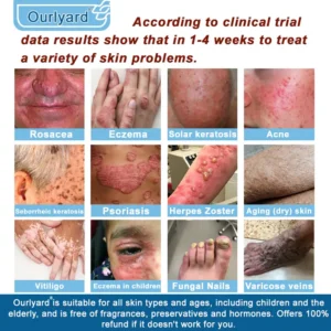 Ourlyard® Magnesium skin repair cream 20 Ourlyard® Magnesium skin repair cream