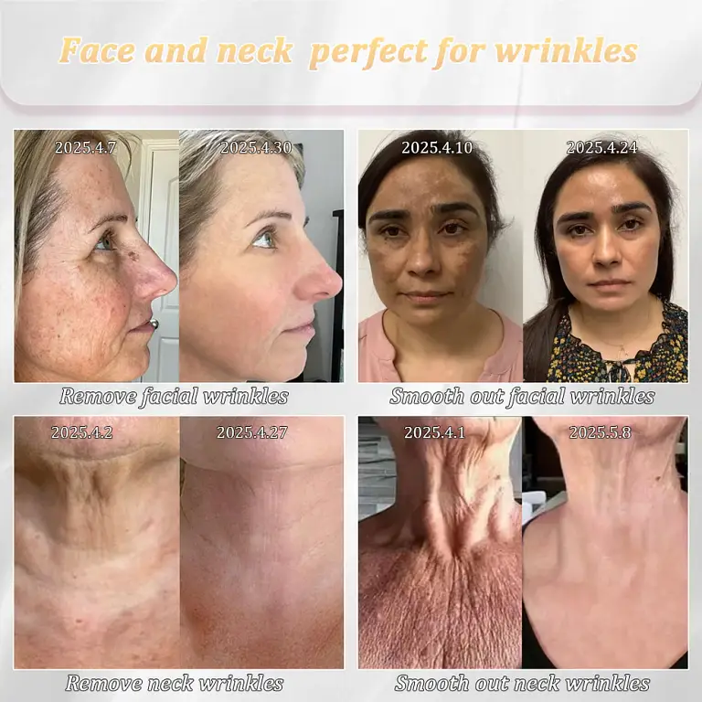 Jorondy® Erase Sagging Skin 10 Jorondy® Erase Sagging Skin