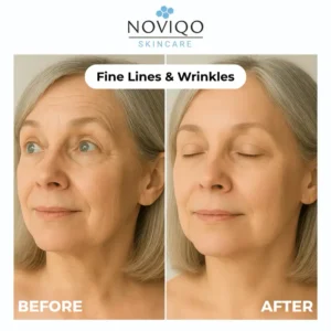 Noviqo™ – Anti-Wrinkle Freeze-Dried Nano-Silk Collagen System 12 Noviqo™ – Anti-Wrinkle Freeze-Dried Nano-Silk Collagen System