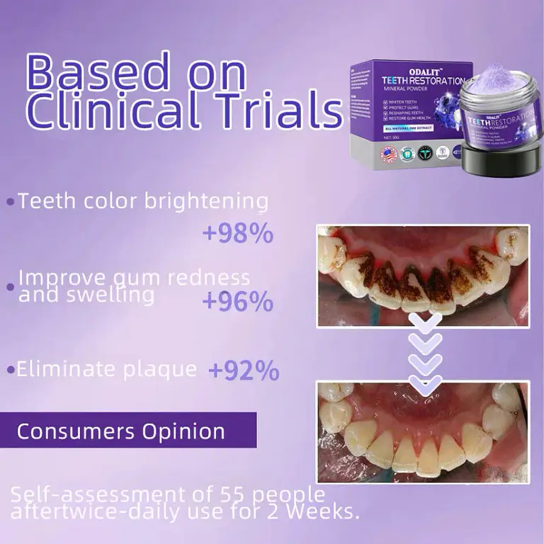 ODALIT™ TeethRestoration Mineral Powder 17 ODALIT™ TeethRestoration Mineral Powder