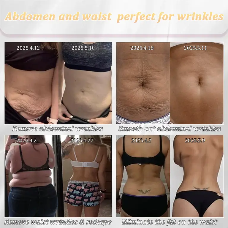 Jorondy® Erase Sagging Skin 9 Jorondy® Erase Sagging Skin