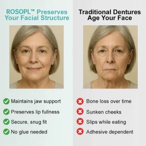 ROSOPL™ Advanced Customized Full Denture Set 22 ROSOPL™ Advanced Customized Full Denture Set
