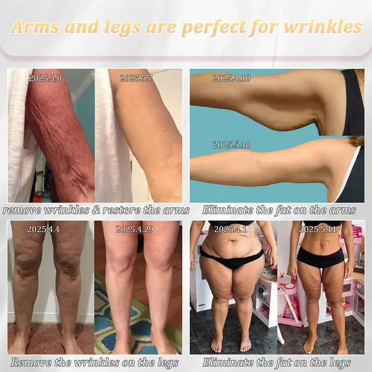 Jorondy® Erase Sagging Skin 8 Jorondy® Erase Sagging Skin