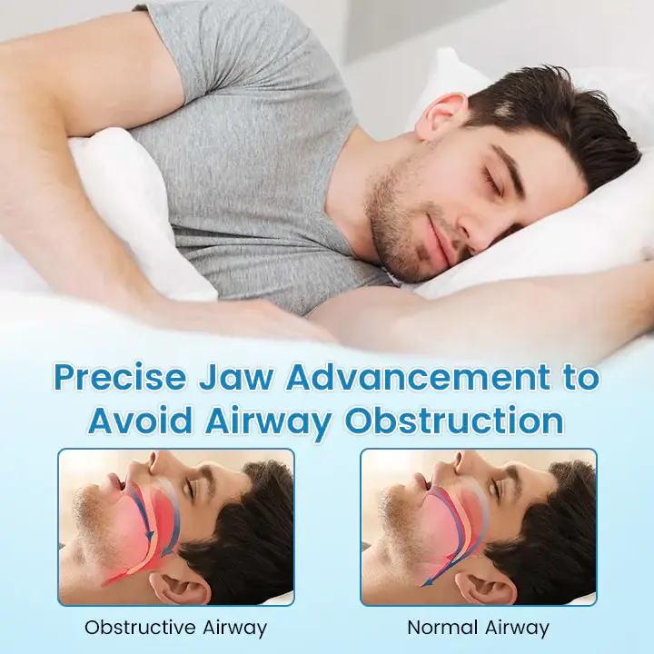 JEREMYTIS™ Adjustable Anti-Snoring Mouthpiece 9 JEREMYTIS™ Adjustable Anti-Snoring Mouthpiece