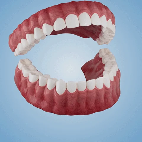 Nurbini™ Advanced Customized Full Denture Set 9 Nurbini™ Advanced Customized Full Denture Set
