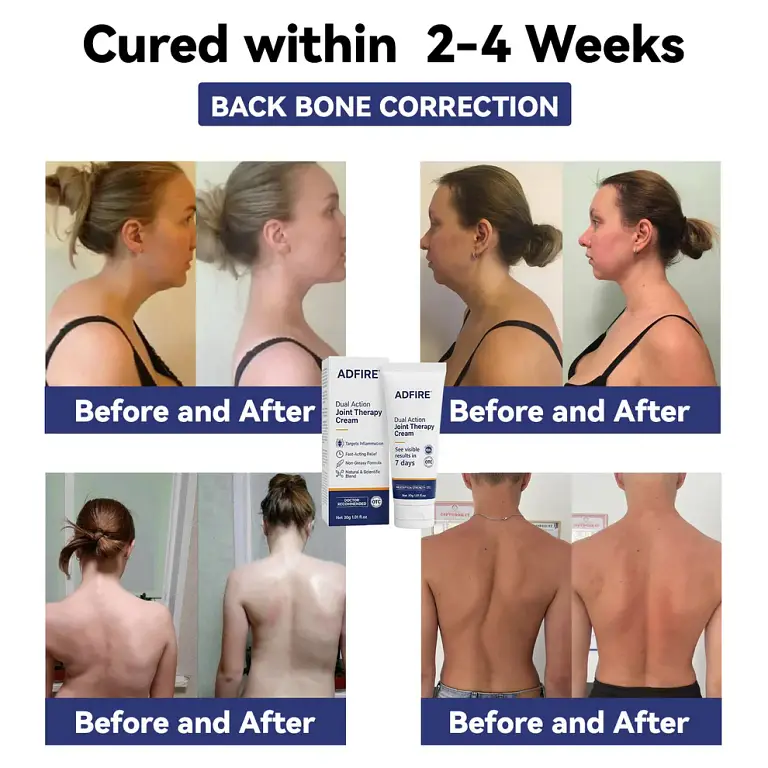 ADFIRE® Dual Action Pain Relief 9 ADFIRE® Dual Action Pain Relief