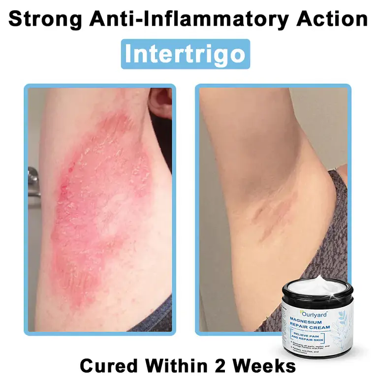 Ourlyard® Magnesium skin repair cream 7 Ourlyard® Magnesium skin repair cream