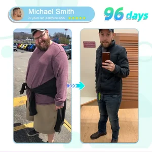 ADFIRE® NIDDK-Tirzepatide Slimming & health NANO MICRONEEDLE PATCH 17 ADFIRE® NIDDK-Tirzepatide Slimming & health NANO MICRONEEDLE PATCH