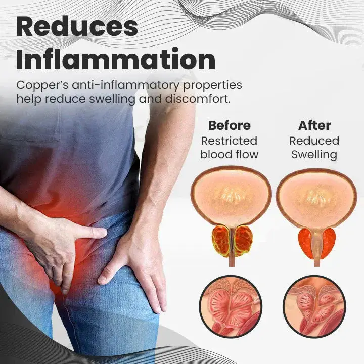 Histone™ Copper Mag Prostate Therapy Ring 8 Histone™ Copper Mag Prostate Therapy Ring