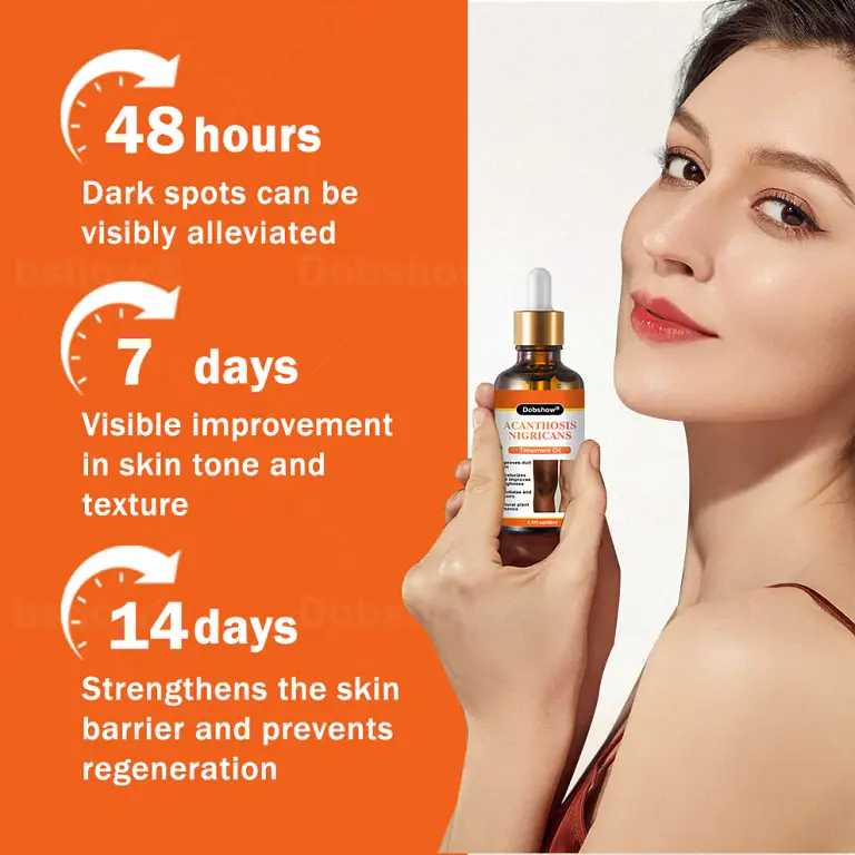 Dobshow® Acanthosis Nigricans Treatment Oil 7 Dobshow® Acanthosis Nigricans Treatment Oil