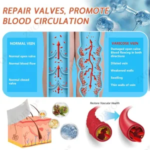 Zvoevo® Vein Ease Microneedle Care Patch