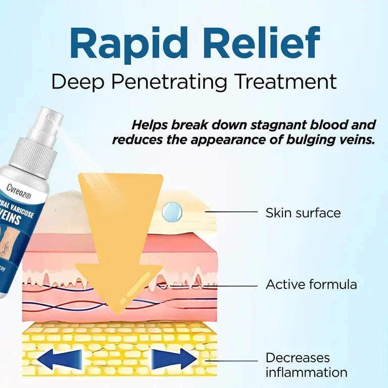 Cvreoz® Herbal Varicose Veins Treatment Spray 6 Cvreoz® Herbal Varicose Veins Treatment Spray
