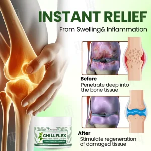 Cvreoz® Chillflex Mint Pain Relief Cream 13 Cvreoz® Chillflex Mint Pain Relief Cream