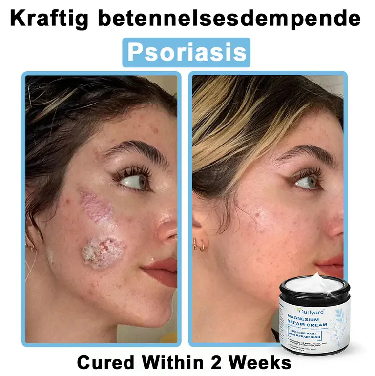 Ourlyard® Magnesium skin repair cream 8 Ourlyard® Magnesium skin repair cream