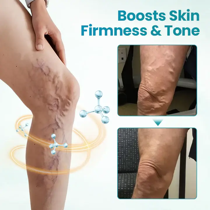 Timilk® VeinAway Relief Cream 7 Timilk® VeinAway Relief Cream