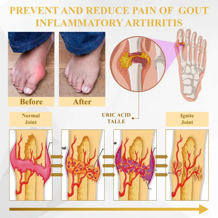 ATTDX® ApiMotion Herbal Joint Comfort Balm 9 ATTDX® ApiMotion Herbal Joint Comfort Balm