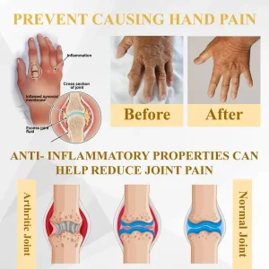 ATTDX® ApiMotion Herbal Joint Comfort Balm 17 ATTDX® ApiMotion Herbal Joint Comfort Balm