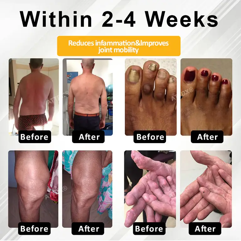 ATTDX® ApiMotion Herbal Joint Comfort Balm 4 ATTDX® ApiMotion Herbal Joint Comfort Balm