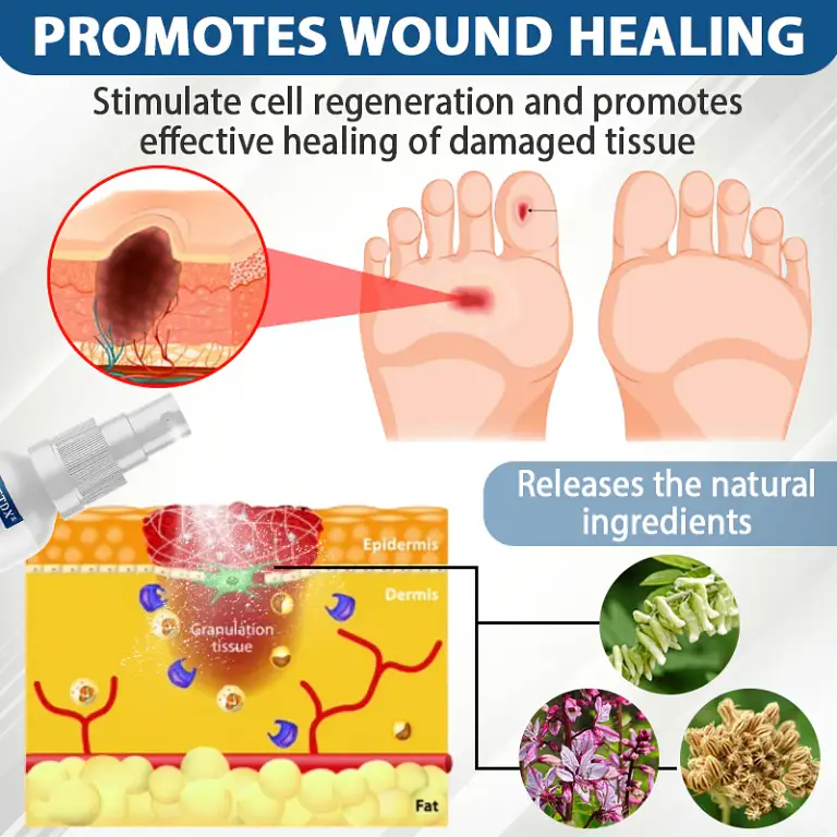 CVREOZ® Diabetes Foot Guard Fast Recovery Spray 9 CVREOZ® Diabetes Foot Guard Fast Recovery Spray