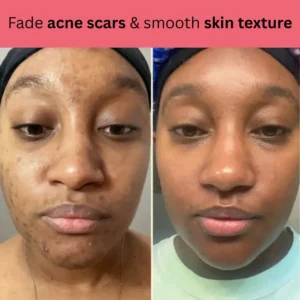 Kojic Acid Turmeric Overnight Mask 15 Kojic Acid Turmeric Overnight Mask