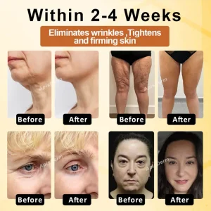 Holikea™ BotoxBee Advanced Multi-Action FirmingCream 100g 18 Holikea™ BotoxBee Advanced Multi-Action FirmingCream 100g