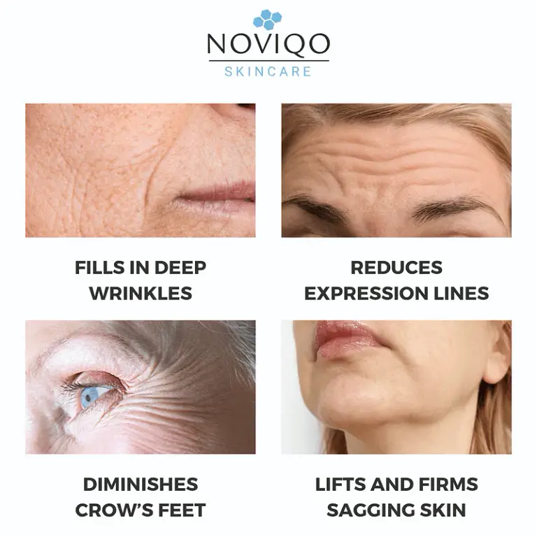 Noviqo™ – Anti-Wrinkle Freeze-Dried Nano-Silk Collagen System 2 Noviqo™ – Anti-Wrinkle Freeze-Dried Nano-Silk Collagen System
