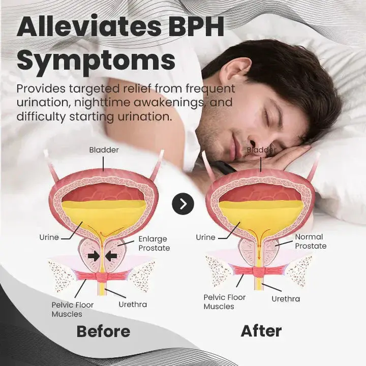 Histone™ Copper Mag Prostate Therapy Ring 3 Histone™ Copper Mag Prostate Therapy Ring