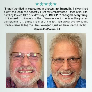 ROSOPL™ Advanced Customized Full Denture Set 14 ROSOPL™ Advanced Customized Full Denture Set