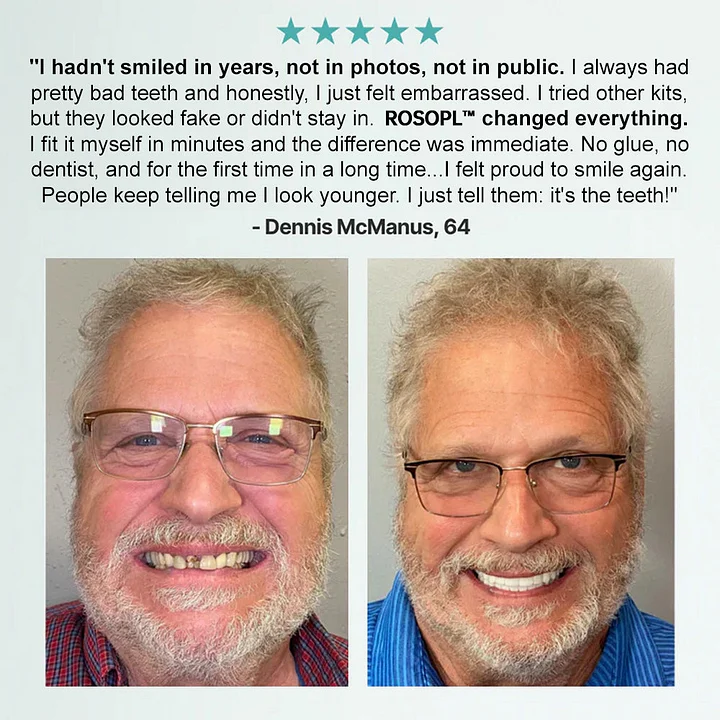 ROSOPL™ Advanced Customized Full Denture Set 3 ROSOPL™ Advanced Customized Full Denture Set