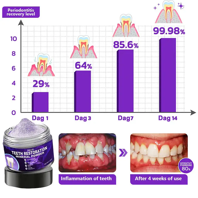BBOJI™ Teeth Restoration Mineral Powder 8 BBOJI™ Teeth Restoration Mineral Powder