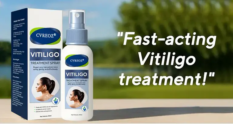 Cvreoz® Vitiligo Treatment Spray 7 Cvreoz® Vitiligo Treatment Spray