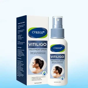 Cvreoz® Vitiligo Treatment Spray