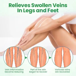 ADFIRE® VeinGuard Herbal Spray 7 ADFIRE® VeinGuard Herbal Spray