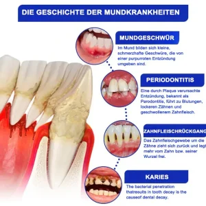 Dobshow® Bee Venom Dental Microgranules 13 Dobshow® Bee Venom Dental Microgranules