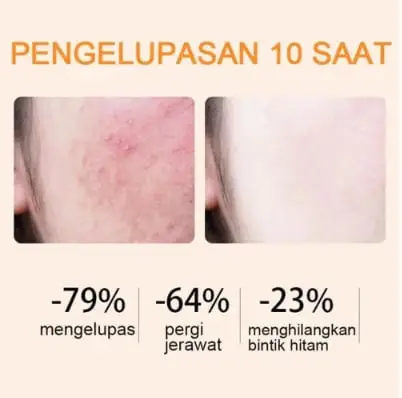 Orange Enzyme Exfoliating Gel — The Gentle Miracle Your Skin 9 Orange Enzyme Exfoliating Gel — The Gentle Miracle Your Skin