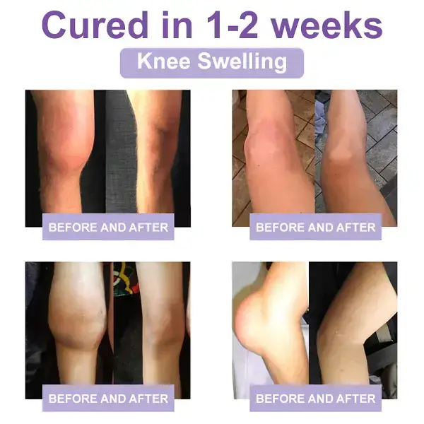 Zvoevo® Magnesium Pain Relief Cream 6 Zvoevo® Magnesium Pain Relief Cream