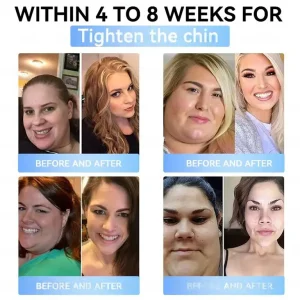 Croaie® GLP-1 Nano-Microneedle Patch with Collagen 8 Croaie® GLP-1 Nano-Microneedle Patch with Collagen