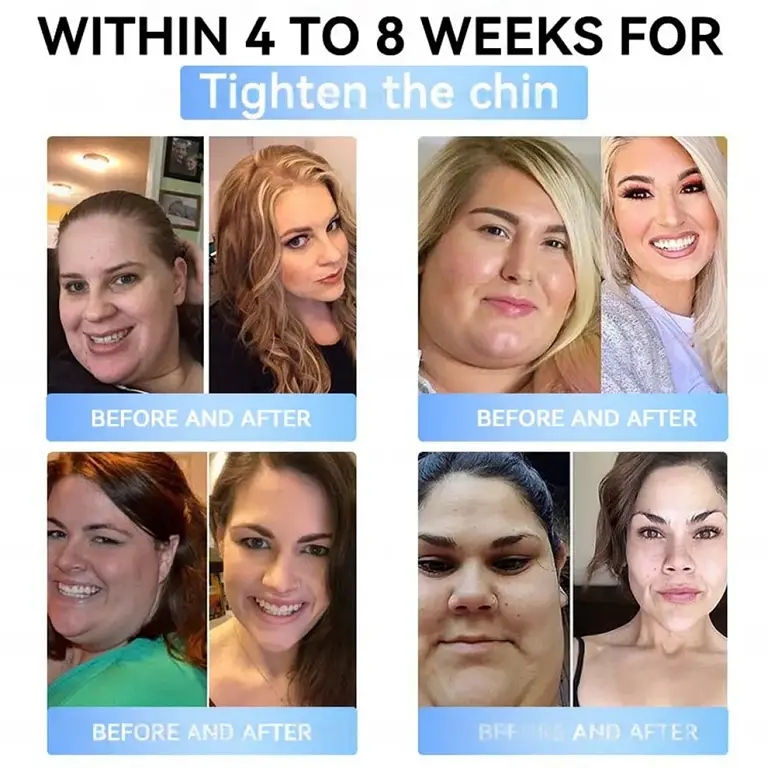 Croaie® GLP-1 Nano-Microneedle Patch with Collagen 2 Croaie® GLP-1 Nano-Microneedle Patch with Collagen