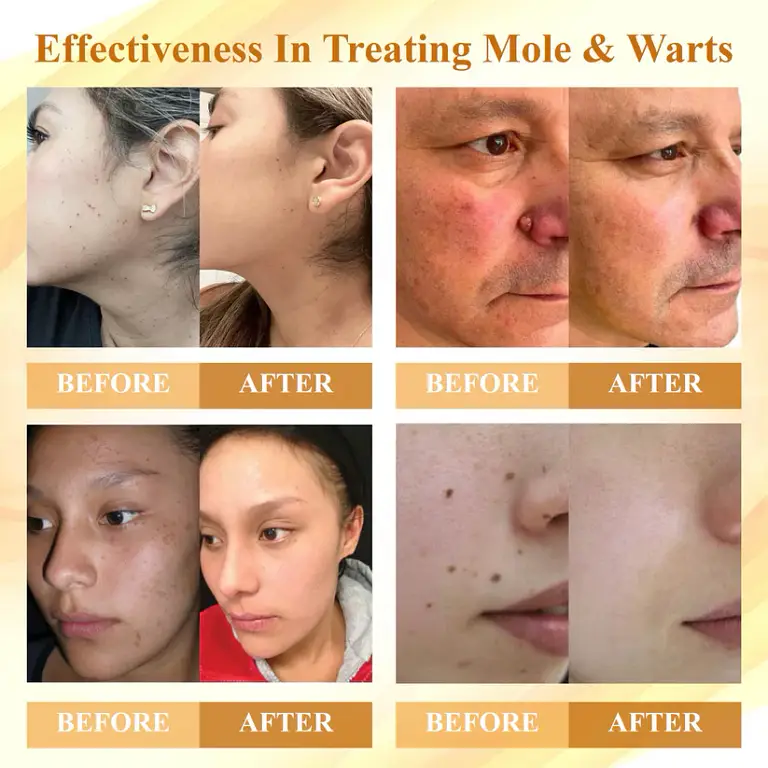 Cvreoz® Condense Mellifera Venom Skin Repairing Cream 9 Cvreoz® Condense Mellifera Venom Skin Repairing Cream