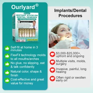 Ourlyard® Instant Stick on Dental Veneers 10 Ourlyard® Instant Stick on Dental Veneers