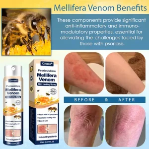 Croaie® PsoriasisCare Mellifera Venom Skin Healing Spray 25 Croaie® PsoriasisCare Mellifera Venom Skin Healing Spray