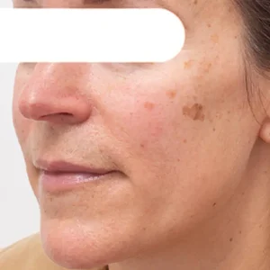 AEXZR® Herbal Stain Peel-Off Face Mask