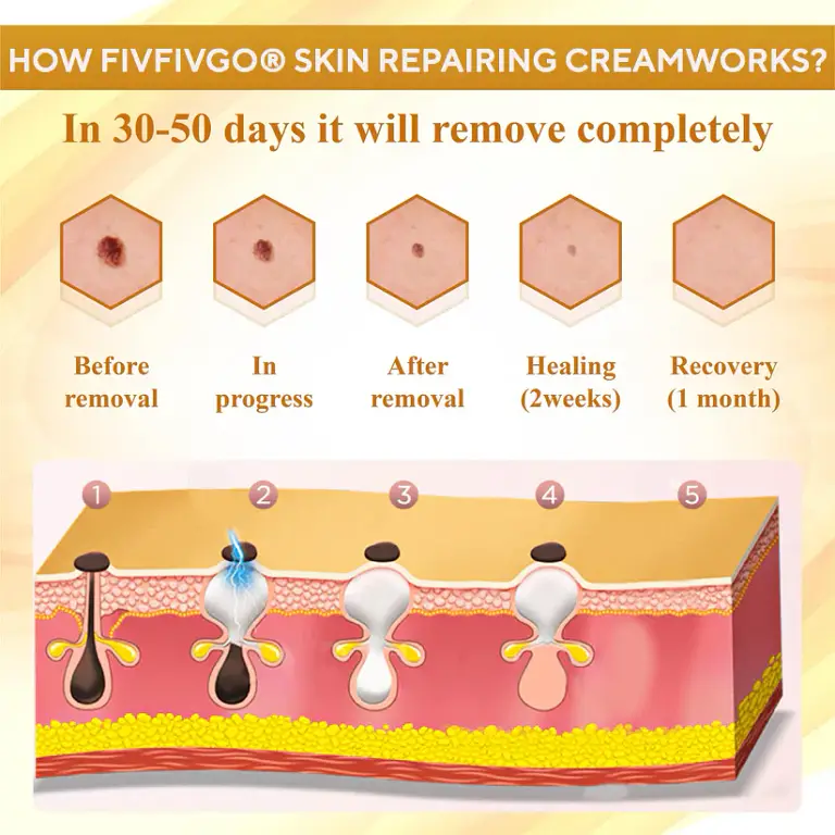 Fivfivgo® Condense Mellifera Venom Skin Repairing Cream 2 Fivfivgo® Condense Mellifera Venom Skin Repairing Cream