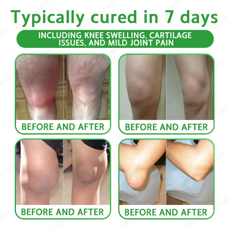 Ourlyard® Advanced Magnesium & Emu Oil Massage Pain Relief Gel 3 Ourlyard® Advanced Magnesium & Emu Oil Massage Pain Relief Gel