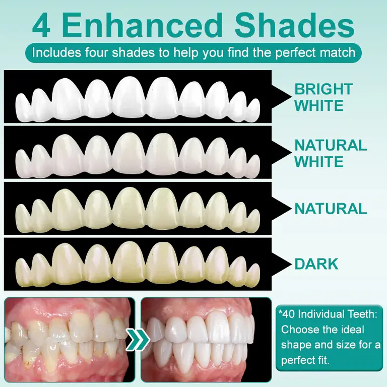 Ourlyard® Instant Stick on Dental Veneers 3 Ourlyard® Instant Stick on Dental Veneers