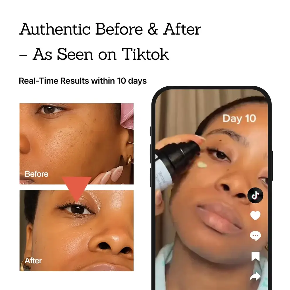 NESLEMY™Retinal Skin Booster Serum 7 NESLEMY™Retinal Skin Booster Serum