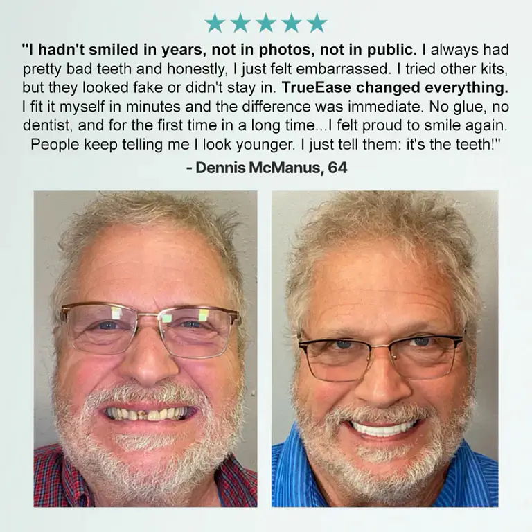 NESLEMY™ Advanced Customized Full Denture Set 6 NESLEMY™ Advanced Customized Full Denture Set