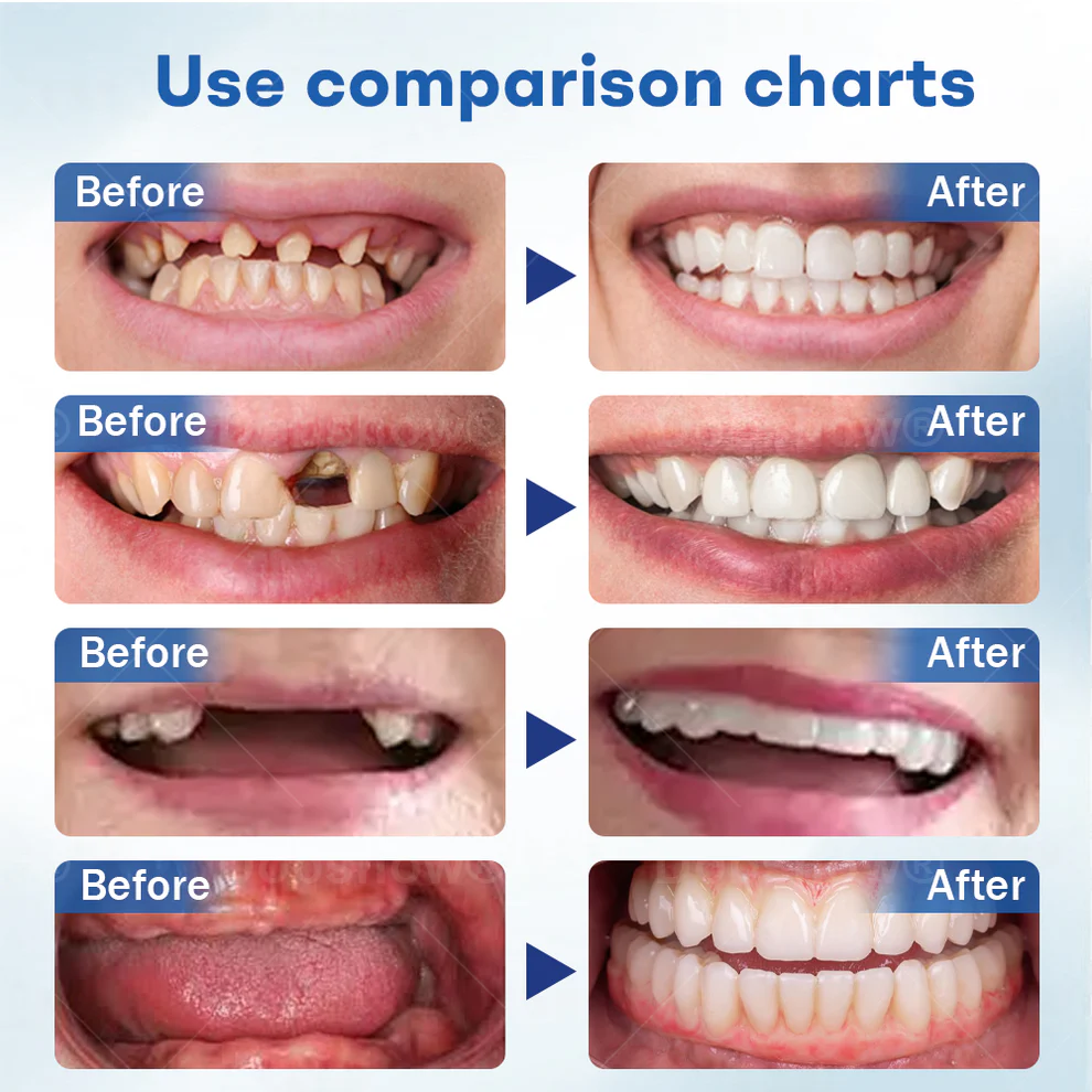 Nurbini® ThermoSeal Fresh Denture 6 Nurbini® ThermoSeal Fresh Denture