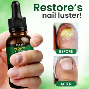 AEXZR® Fungal Nail Treatment 8 AEXZR® Fungal Nail Treatment