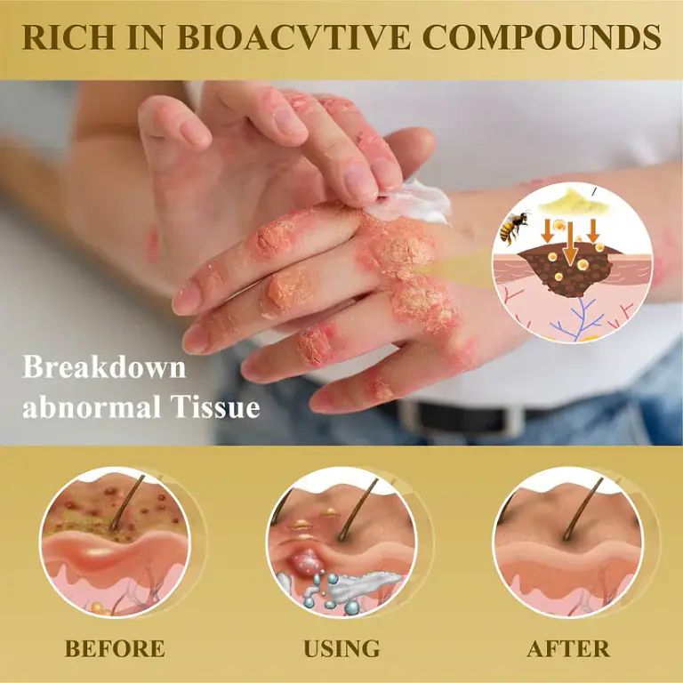 Cvreoz® Condense Mellifera Venom Skin Repairing Cream 5 Cvreoz® Condense Mellifera Venom Skin Repairing Cream